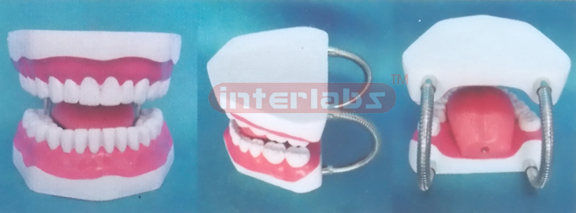 MIDDLE-LITTLE SANS TOOTH GAP FIXED DENTAL CARE MODEL OF THE GAP FIXED WITH TONGE